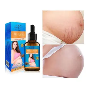 The Snail Stretch Mark Oil