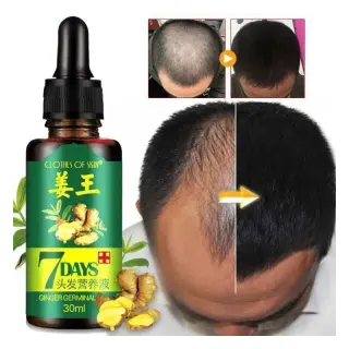 Hair Growth Oil